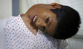 大头娃娃奶粉事件原因 大头娃娃奶粉事件原因