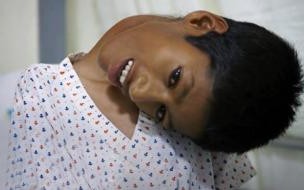 大头娃娃是因为劣质奶粉缺少什么造成的 大头娃娃奶粉事件原因